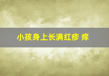 小孩身上长满红疹 痒